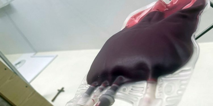 Krwi potrzebuje Pawel Holubowicz