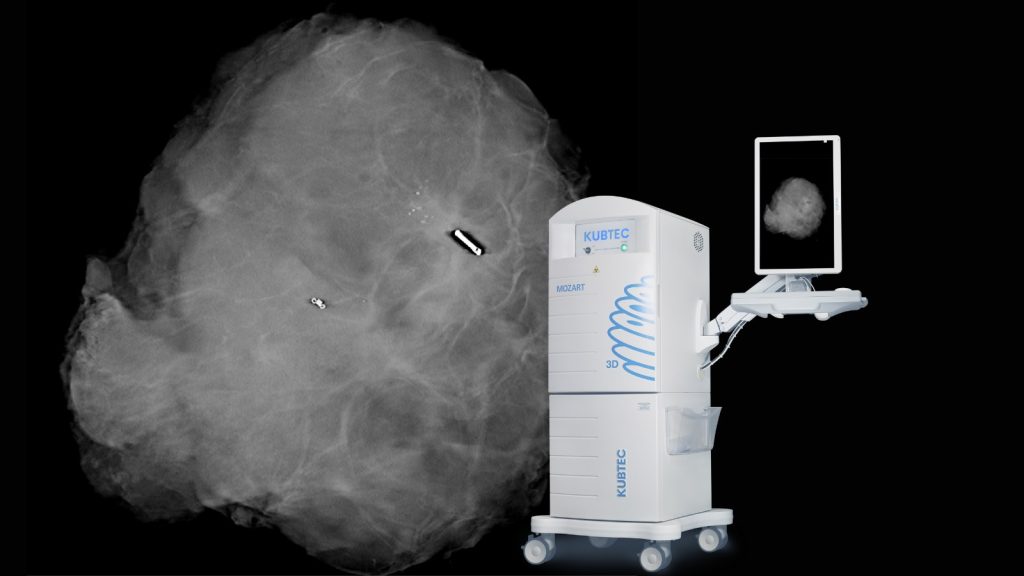 Nowoczesny sprzęt do diagnostyki nowotworów w suwalskim szpitalu 3 655989826 1481564796828308 8378835640884320036 n